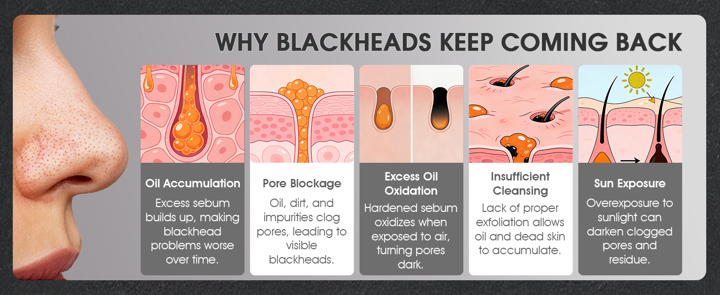 Blackhead Remover Mask Kit