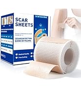 Silicone Scar Sheets, Medical Grade Silicone Scar Tape(1.6" x 60" Roll - 1.5M), Scar Tape for Sur...