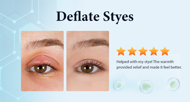 eye compress for dry eyes