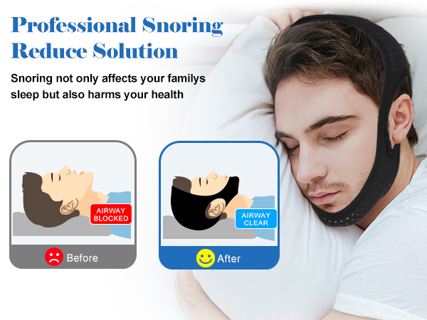 anti snoring devices