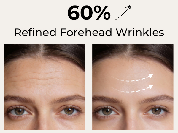 forehead