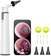 Wireless Otoscope with Gyroscope,AnyScope Ear Camera with Dual View, 3.9 mm Otoscope with Light, ...