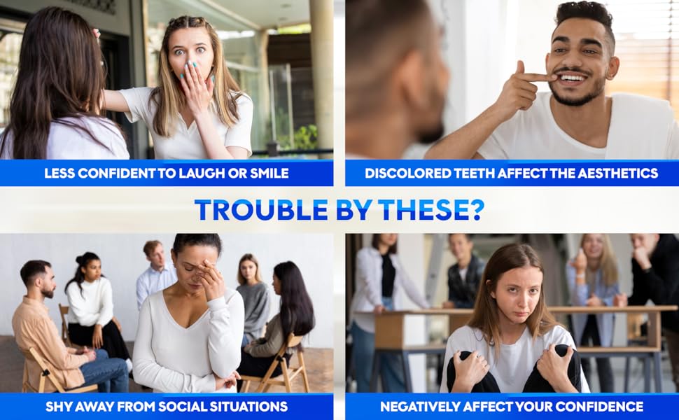 teeth discoloration, lack of confidence, smile anxiety, social embarrassment, emotional impact of ye