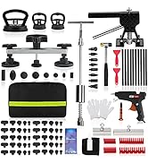 ROADGIVE 100PCS Paintless Dent Repair Kit Professional, DIY Body Repair Dent Removal Tools with B...
