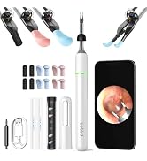 Bebird Pro Note5 Ear Picker with Camera Tweezers, Wireless Wax Removal Tool Camera Cleaner Otosco...