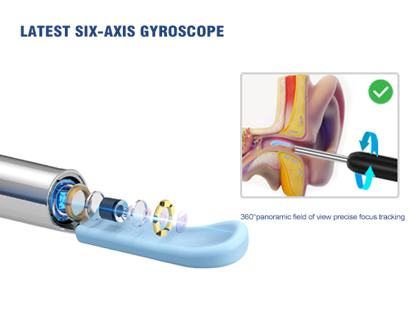 ear camera wax removal