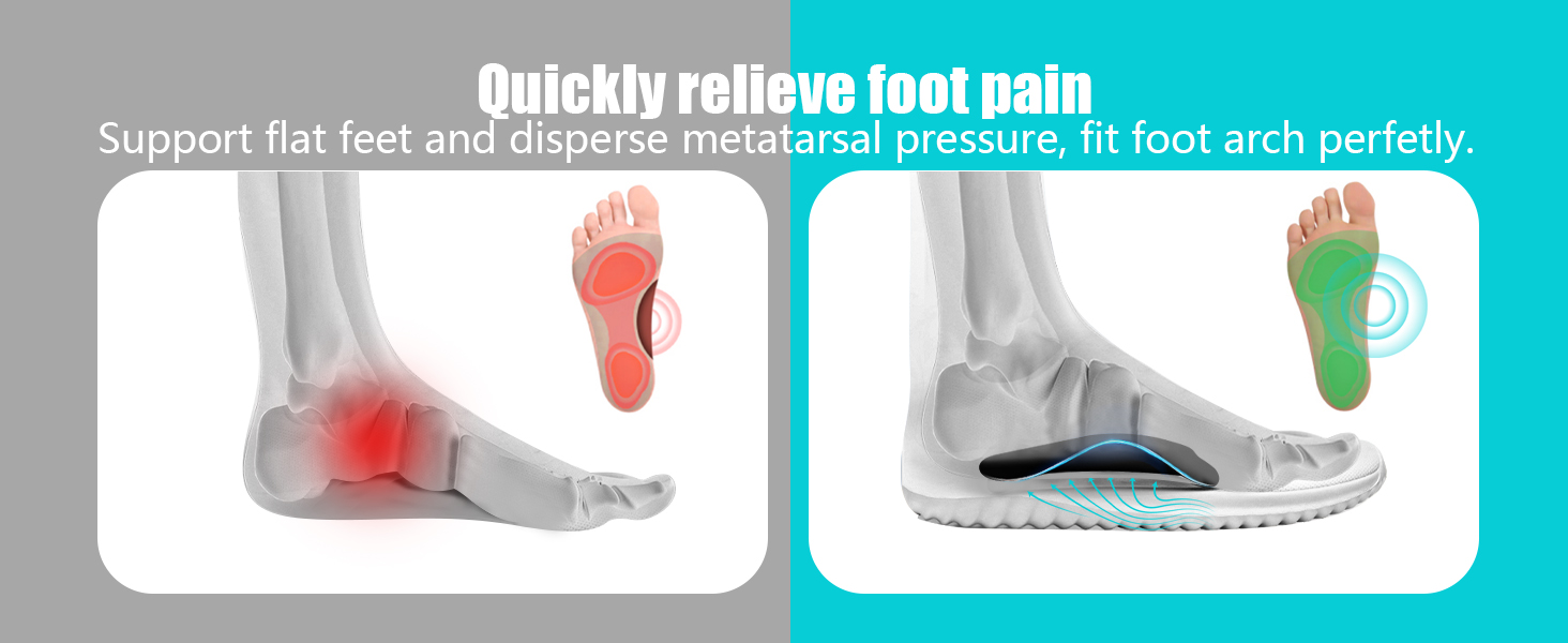 plantar fasciitis relief