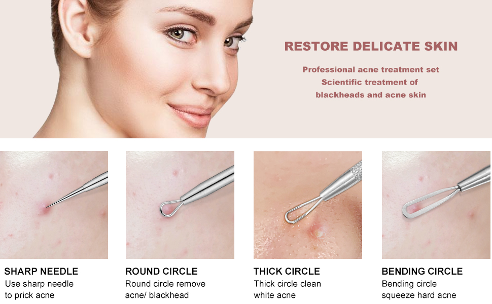 ance remover 