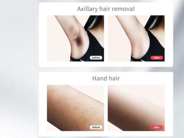 Laser Hair Removal,999,900+ Flashes IPL Hair Removal Device for Women and Men