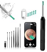 OKUBOX Ear Wax Removal,Ear Cleaner with 1080P Camera,Smart Visual Earwax Cleaning Tool with 6 LED...