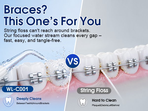 Water Flosser 
