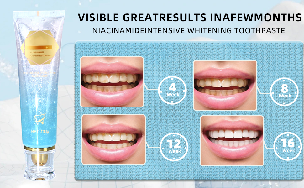 select niacinamide toothpaste whitening