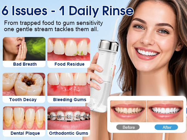 Water Flosser 