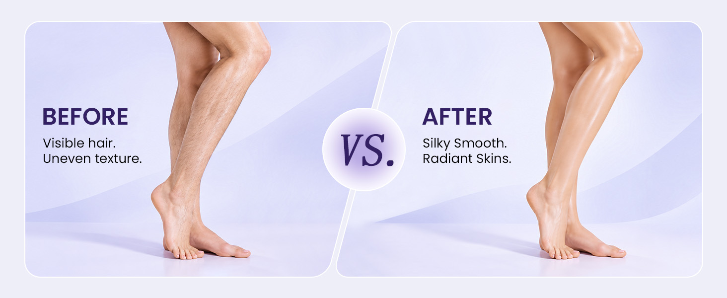 Smooth leg shaver