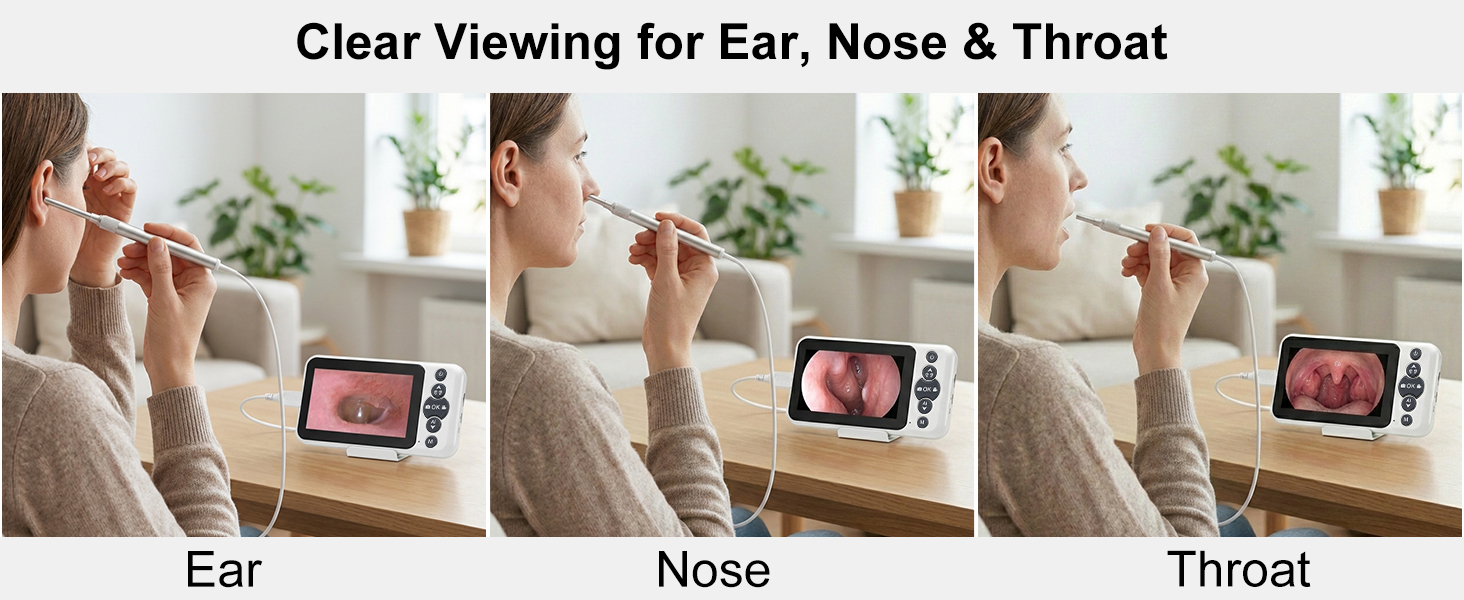 HD screen ear, nose, and throat viewing at home, real-time inspection without app or WiFi