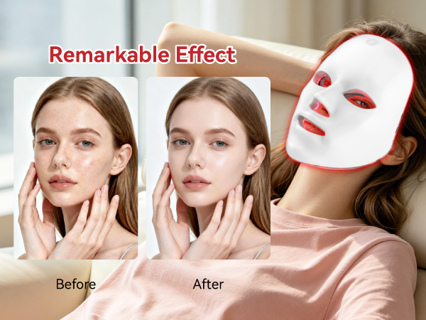 led face mask light therapy 