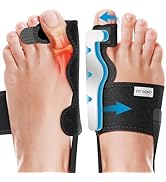 Fit Geno Bunion Corrector Women &amp; Men Big Toe - Adjustable Big Toe Separator for Pain Relief - Ad...