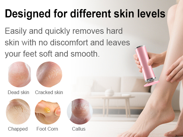 electric callus remover for feet