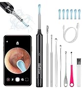 Ear Wax Removal with Camera, Earwax Remover Tool, 1296P FHD Wireless Ear Otoscope with 6 LED Ligh...