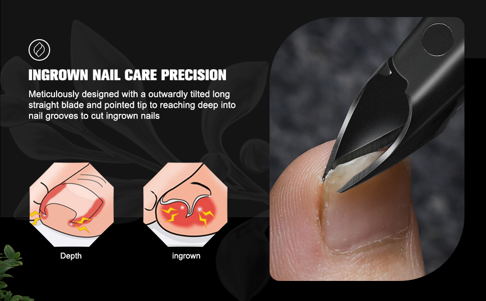 Ingrown Toenail Clipper