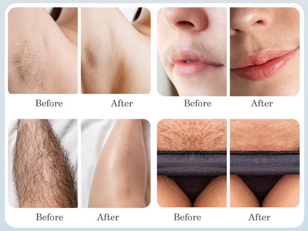 Bikini Trimmer for Women