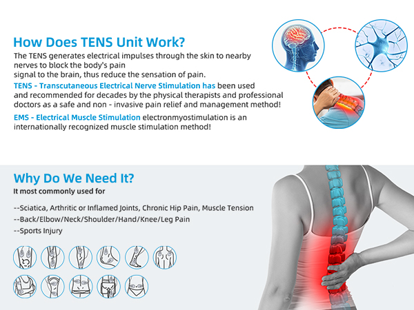 tens unit
