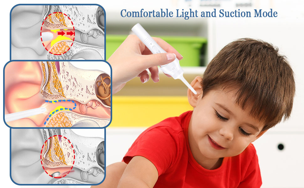 Electric Ear Wax Removal