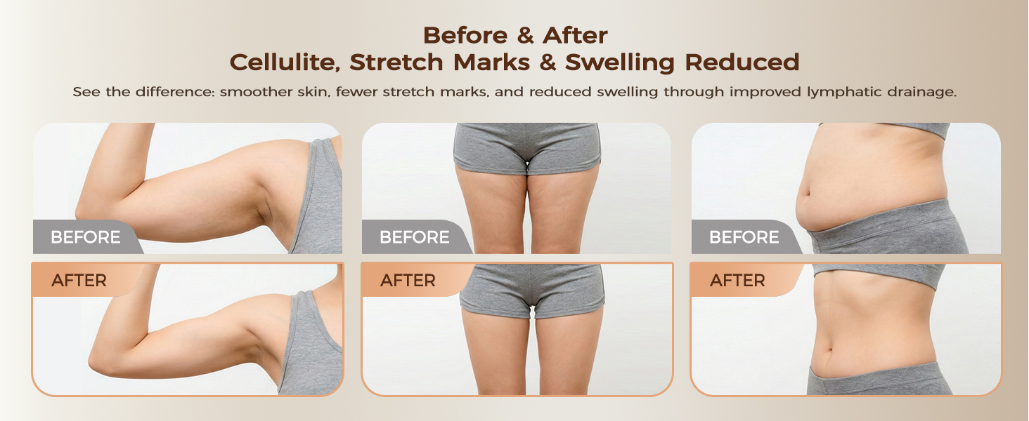 lymphatic drainage tool