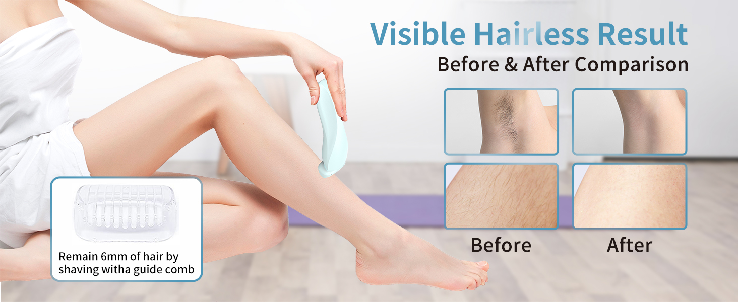 epilators hair removal for women