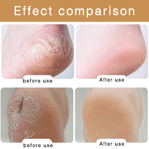 LEKESI FOOT FILE4