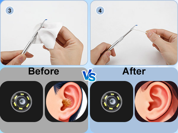 Visual ear wax removal tool before and after effect for ear canal health
