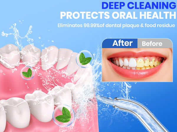 water flosser