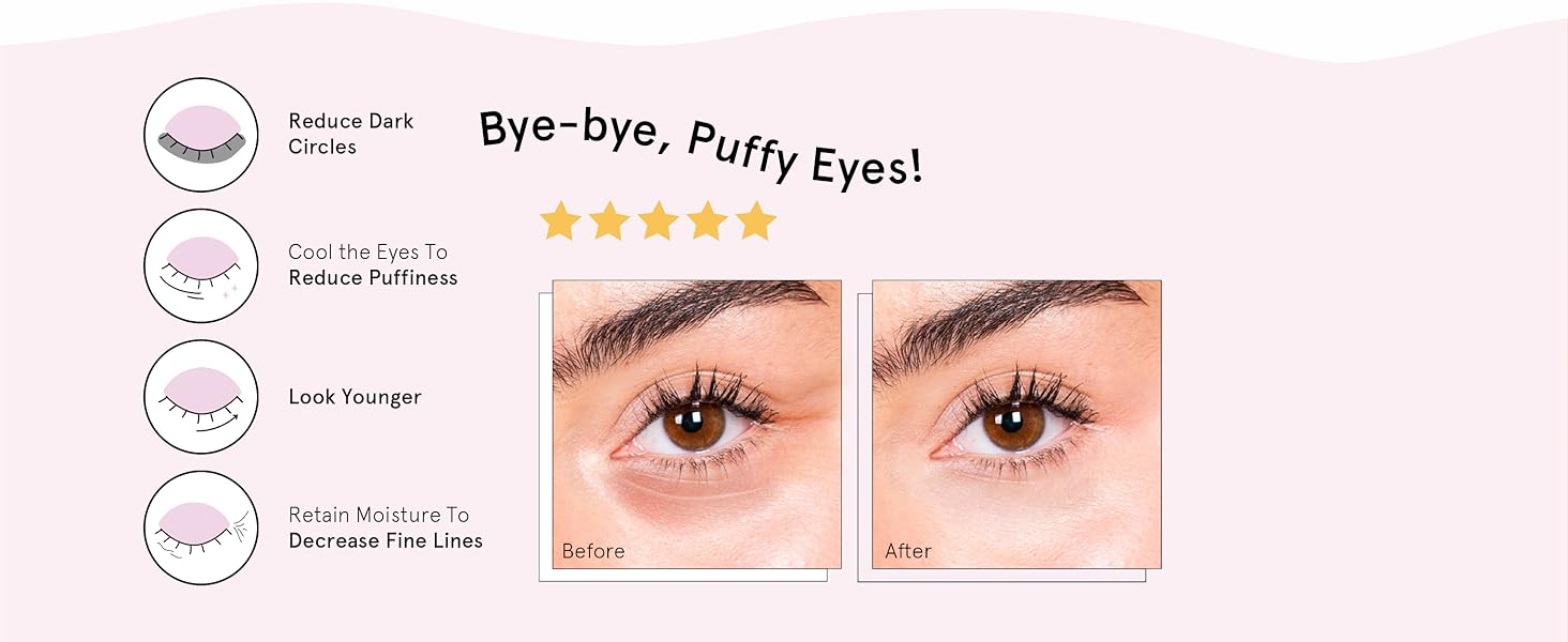 Say goodbye to puffy eyes! grace and stella under eye mask with before and after model comparison