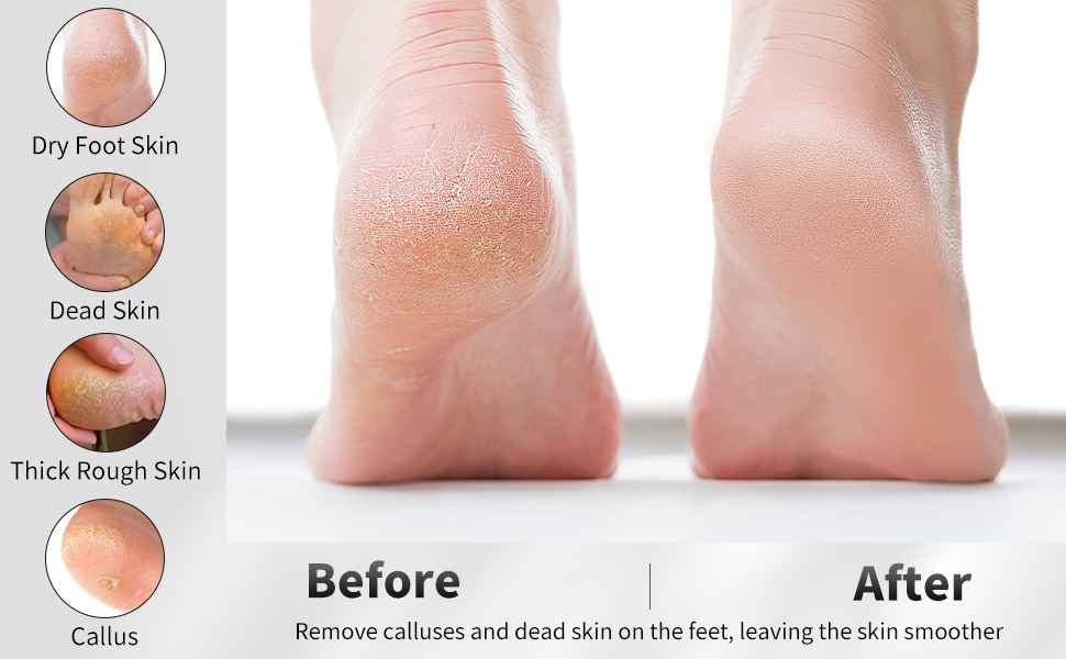 Natural volcanic pumice stone for removing calluses and dead skin
