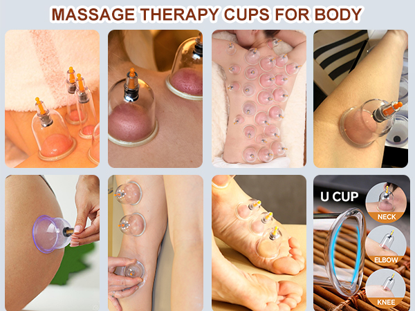 12 cupping kit for massage therapy