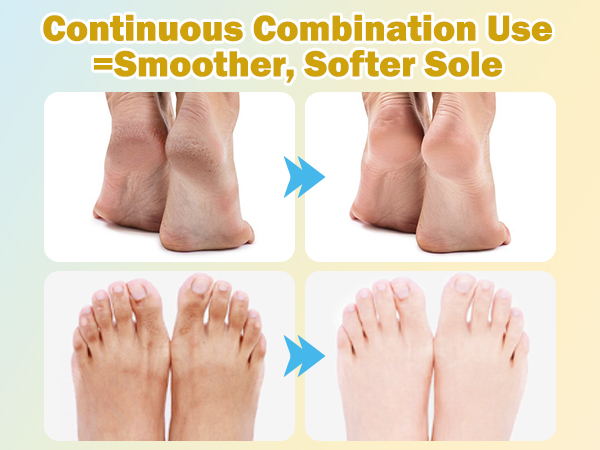 Foot Mask