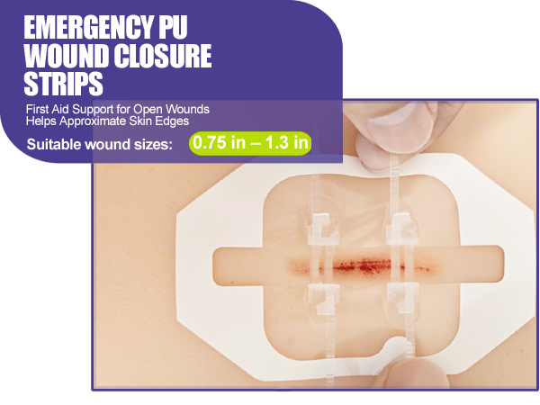 40 Pack Wound Closure Strips