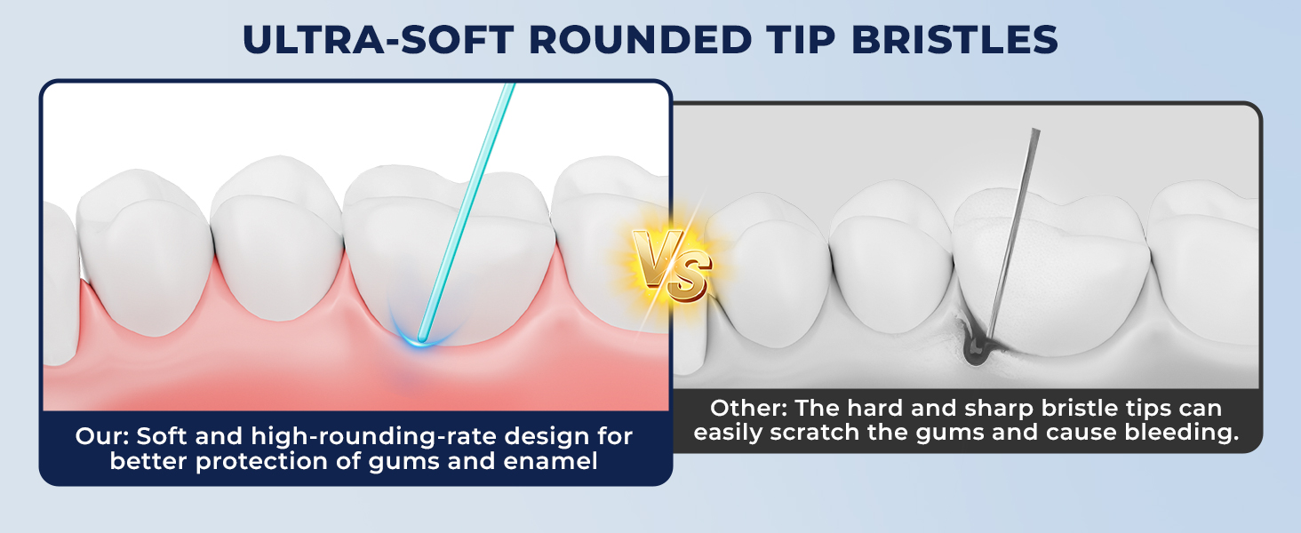 Ultra-soft bristles for gentle gum care