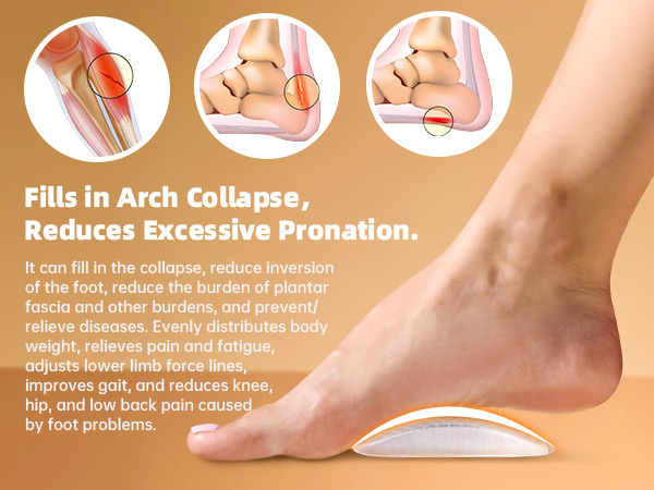 arch support, arch support inserts women, arch support inserts,plantar fasciitis insoles,arch