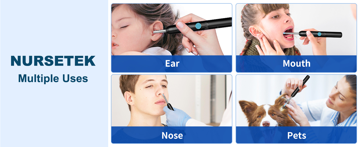 ear cleaning camera