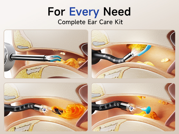Ear Wax Removal Tool Camera