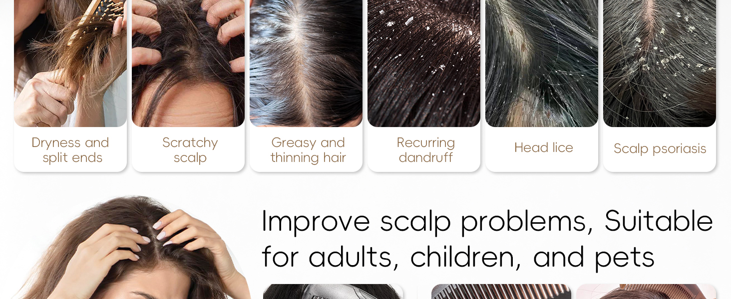 dandruff comb