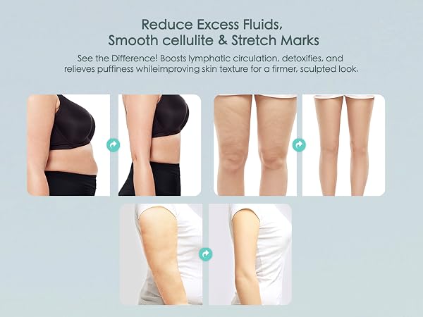 cellulite massage tool