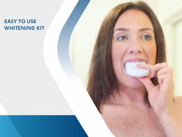 purely white deluxe teeth whitening kit