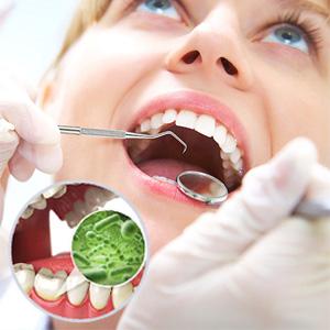 dentist teeth cleaning tools pick picker pickers for dental tools remover plaque and tartar