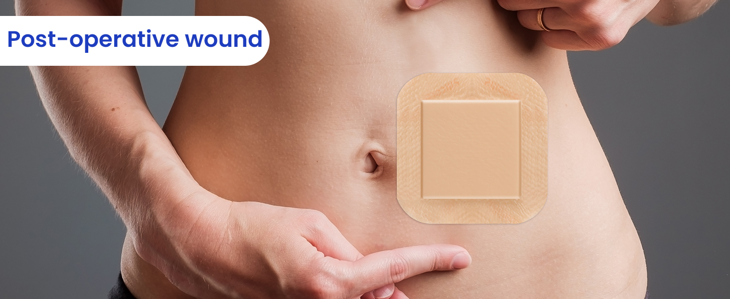 Silicone Foam Dressing