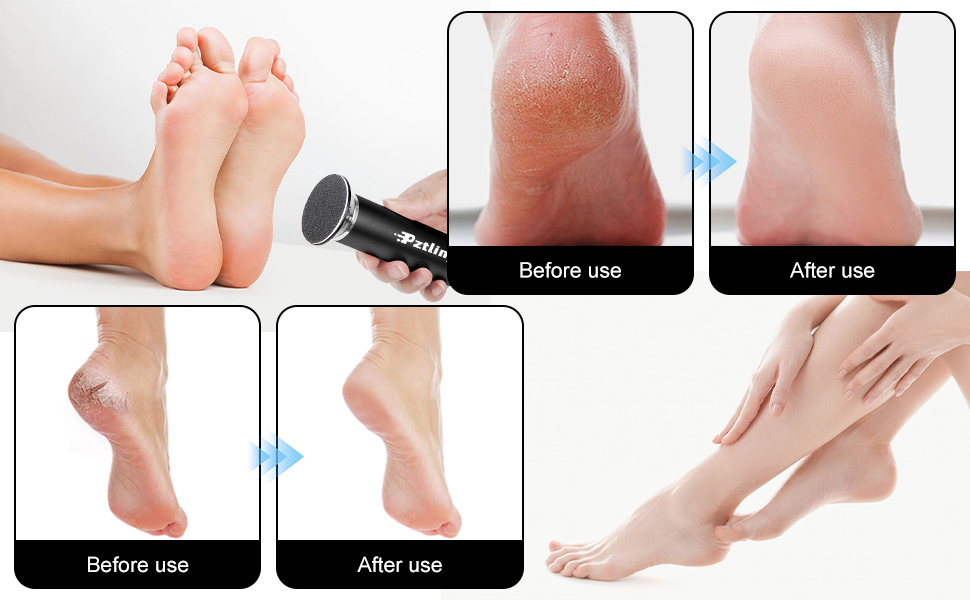 electric foot file