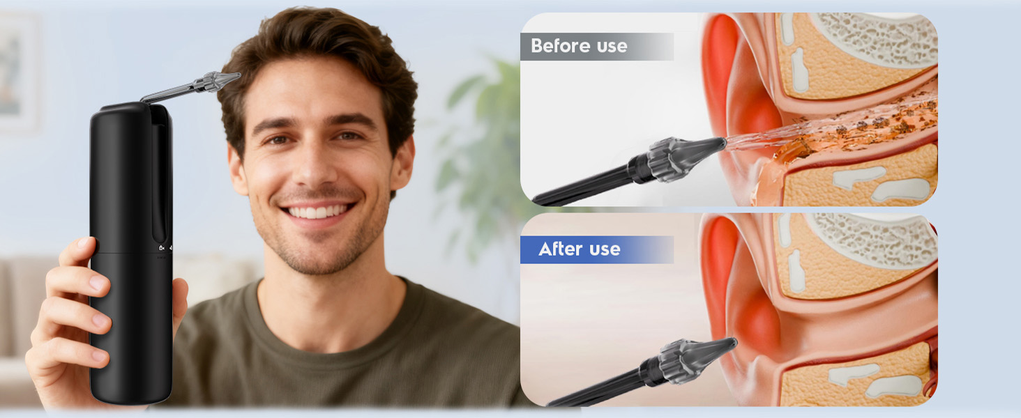 Before &amp;amp; After