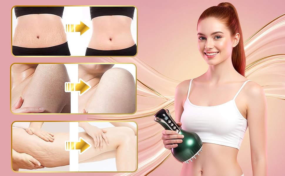 masajeador para celulitis y grasa abdominal de madera;lymphatic massager;lymphatic drainage massage
