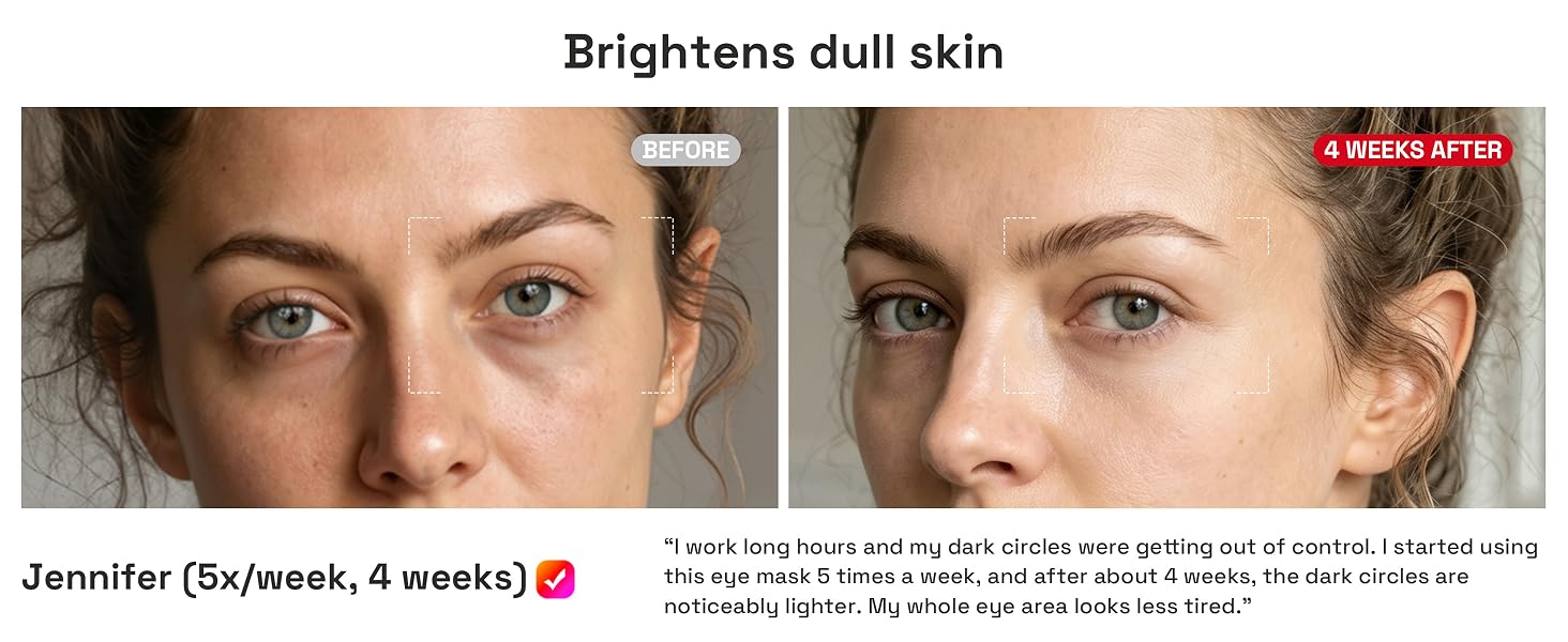 Brightens dull skin